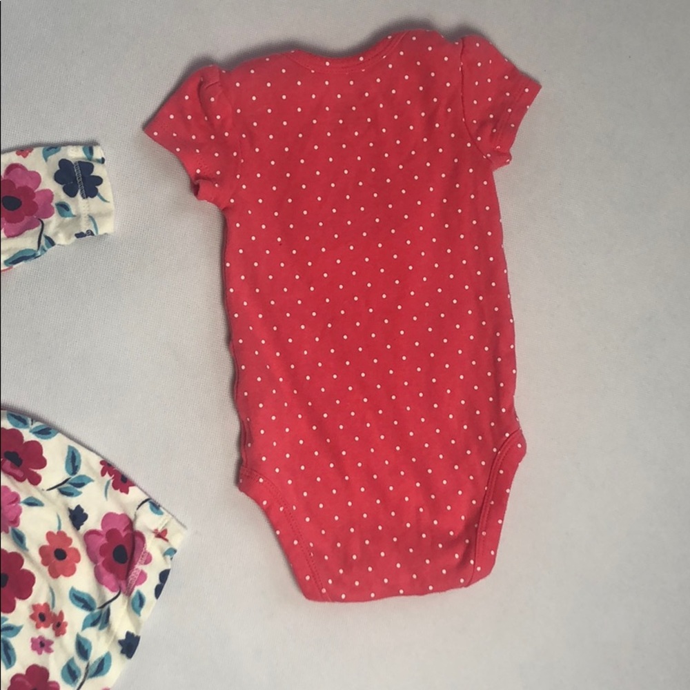 Baby Dress/Onesie Clothing Bundle - Picture 5 of 7
